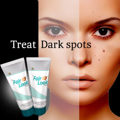 FairLook-Dark Spots